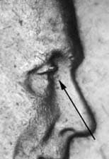 1952-S Doubled Die Obverse DDO-001